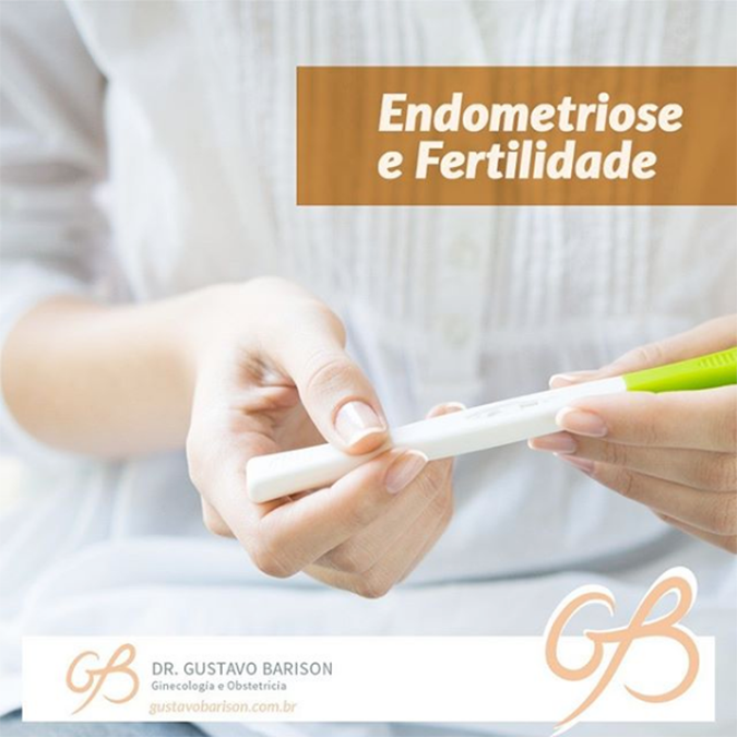 Endometriose e Fertilidade