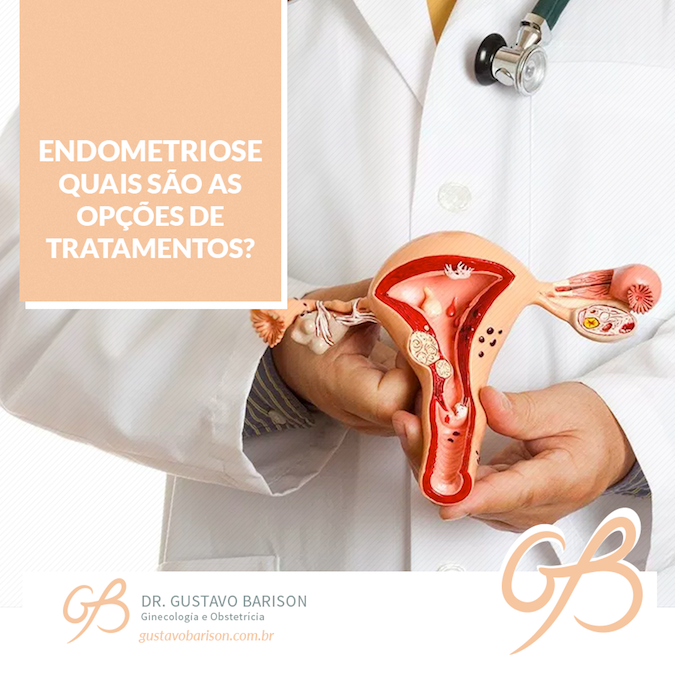 Endometriose: quais são as opções de tratamento?