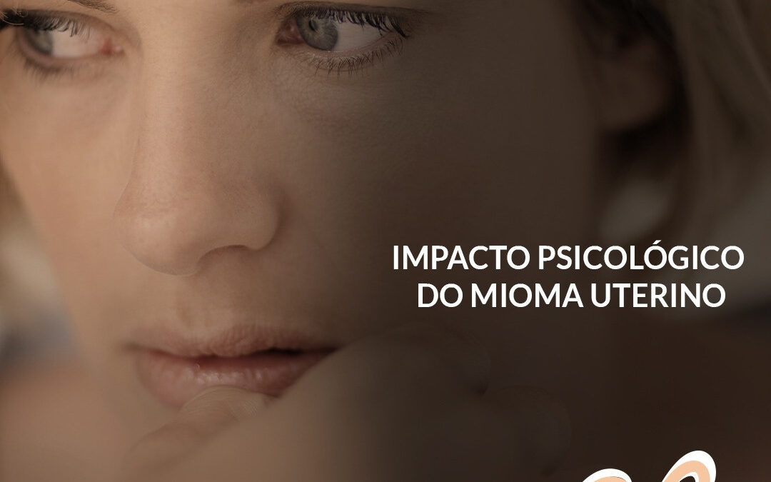 IMPACTO PSICOLÓGICO DO MIOMA UTERINO